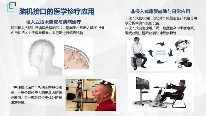 脑科疾病治疗迎来新纪元 《2022北京医工交叉创新战略前沿技术十大趋势》释放关键信号