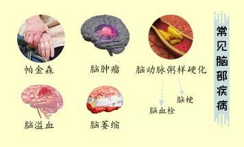 你的大脑“亚健康”了吗？这些事情越早知道越好！